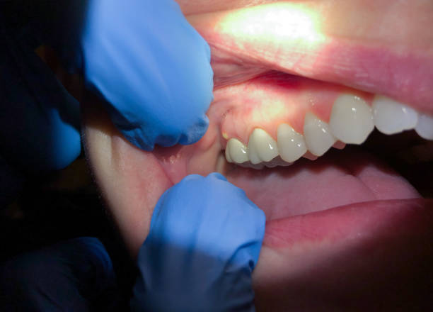 Best Emergency Broken Tooth Repair in Golden Triangle, NJ